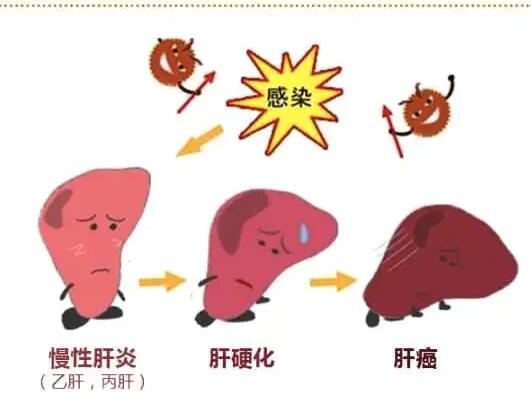 午夜香蕉视频廠家提醒肝髒疾病治不好？要了解是否含鐵食物攝入多